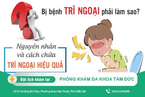 Cách trị bệnh trĩ ngoại tại nhà