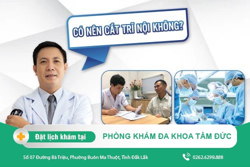 Trĩ nội có nên cắt hay không?