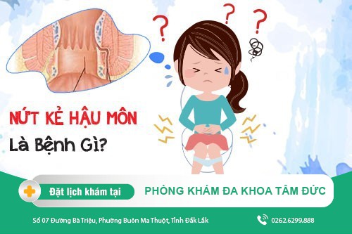 Bệnh nứt kẽ hậu môn và những dấu hiệu thường gặp