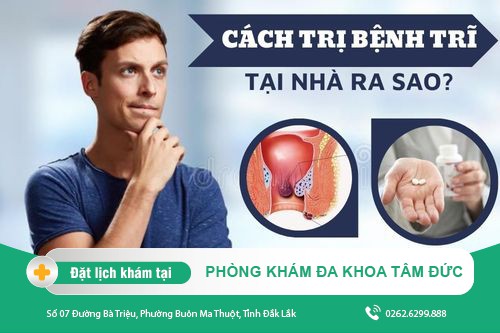 Cách điều trị bệnh trĩ tại nhà đơn giản