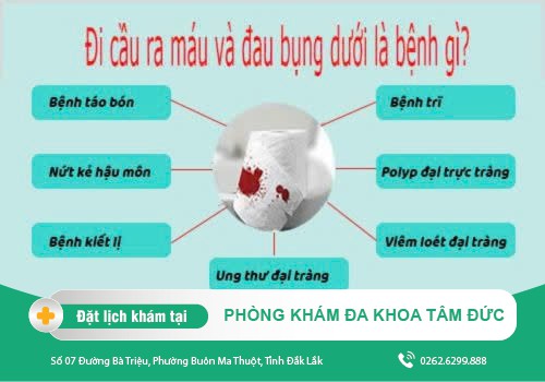 Nguyên nhân đi cầu ra máu tươi